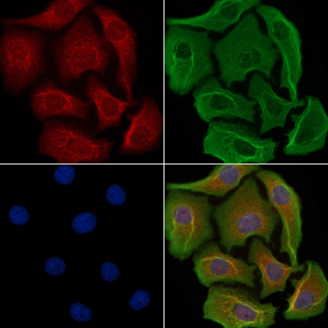 ANKK1 Antibody in Immunocytochemistry (ICC/IF)