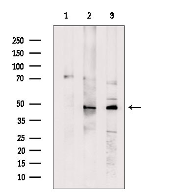 IPMK Antibody in Western Blot (WB)