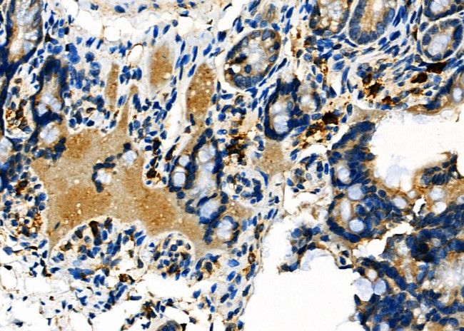 RIN3 Antibody in Immunohistochemistry (Paraffin) (IHC (P))