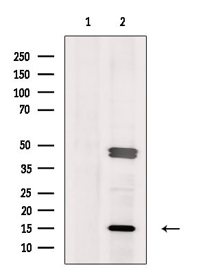 ORAOV1 Antibody in Western Blot (WB)