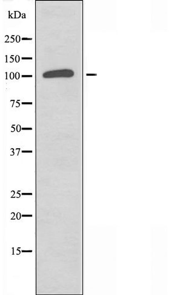 CNKSR2 Antibody in Western Blot (WB)
