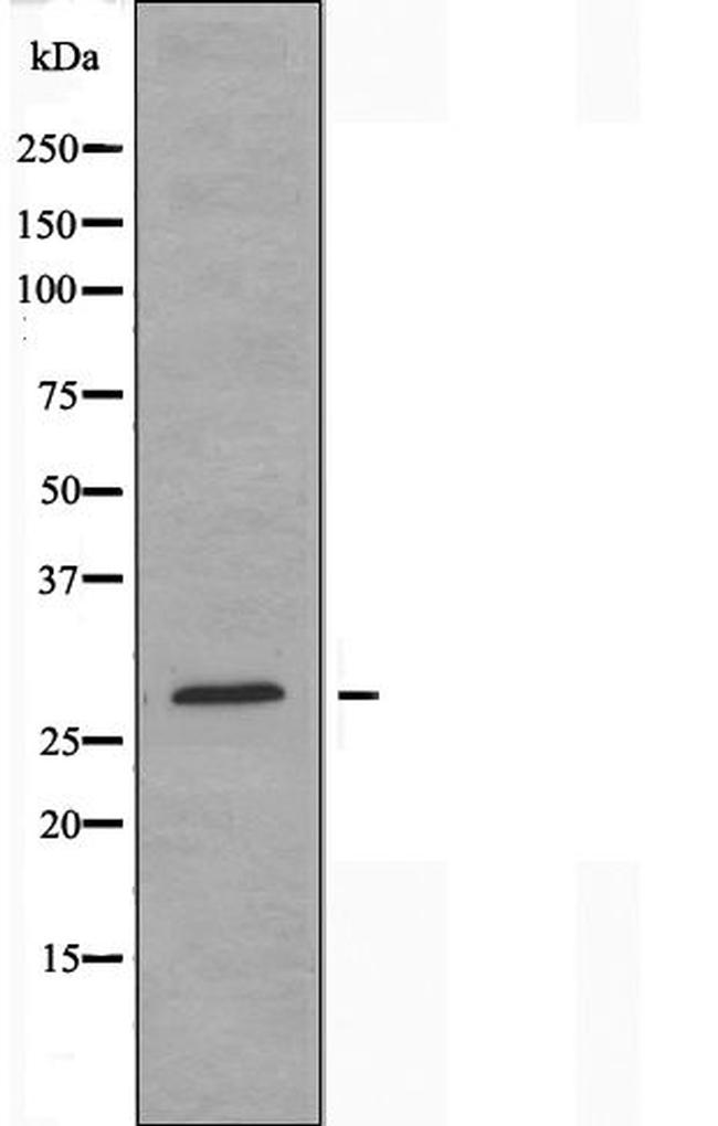 BRI3BP Antibody in Western Blot (WB)