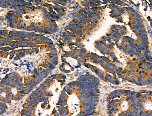 AKAP1 Antibody in Immunohistochemistry (Paraffin) (IHC (P))