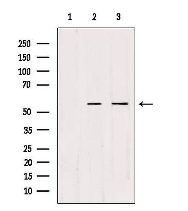 CDKL2 Antibody in Western Blot (WB)
