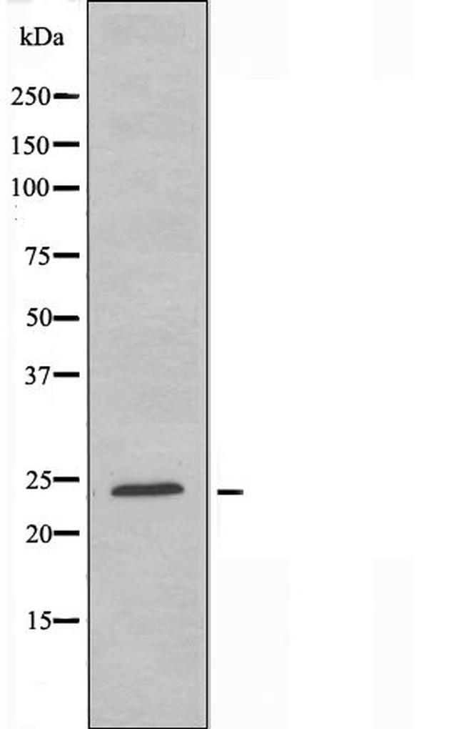 MOB3A/MOB3B Antibody in Western Blot (WB)
