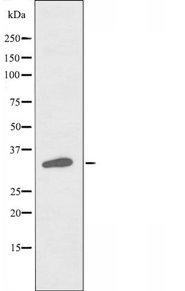 RASD2 Antibody in Western Blot (WB)