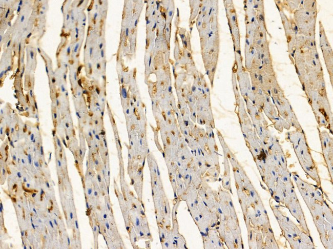 FAM84B Antibody in Immunohistochemistry (Paraffin) (IHC (P))