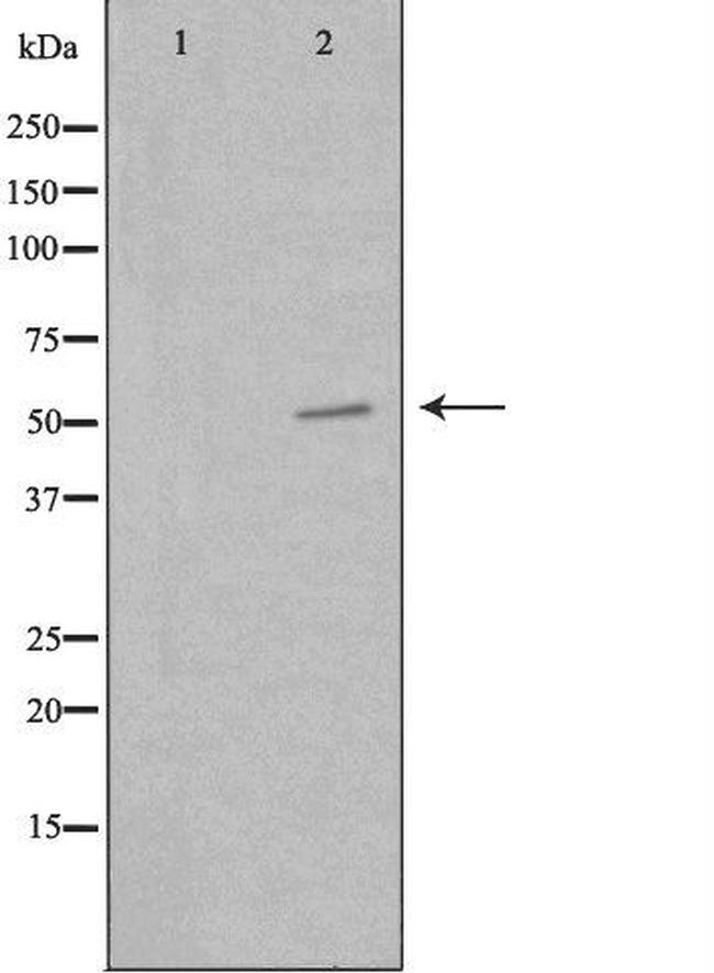 PKNOX2 Antibody in Western Blot (WB)