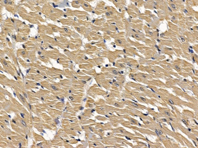 LMTK3 Antibody in Immunohistochemistry (Paraffin) (IHC (P))