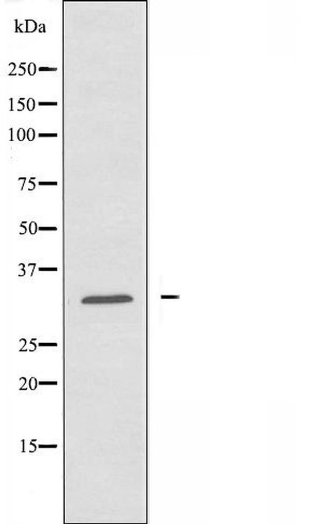 CIB3 Antibody in Western Blot (WB)