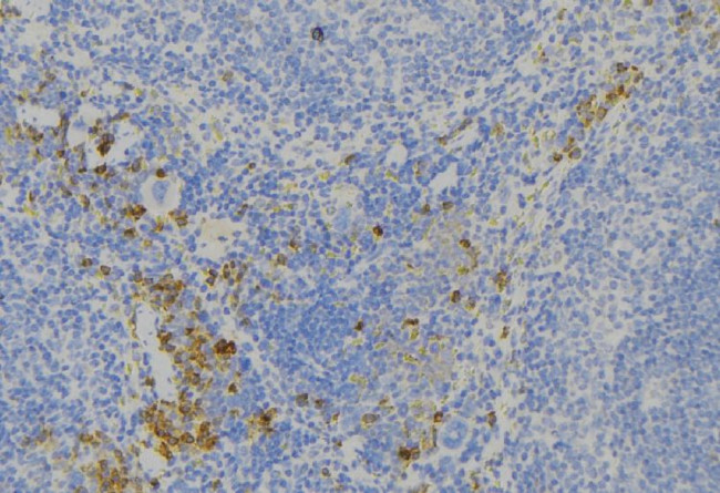 ALPK1 Antibody in Immunohistochemistry (Paraffin) (IHC (P))