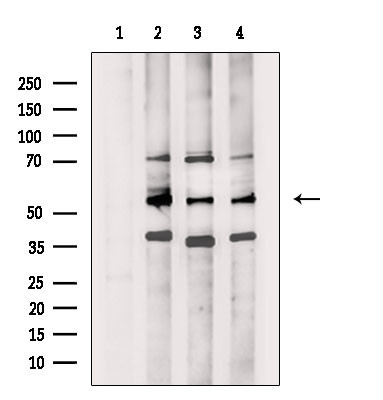 SERC2 Antibody in Western Blot (WB)