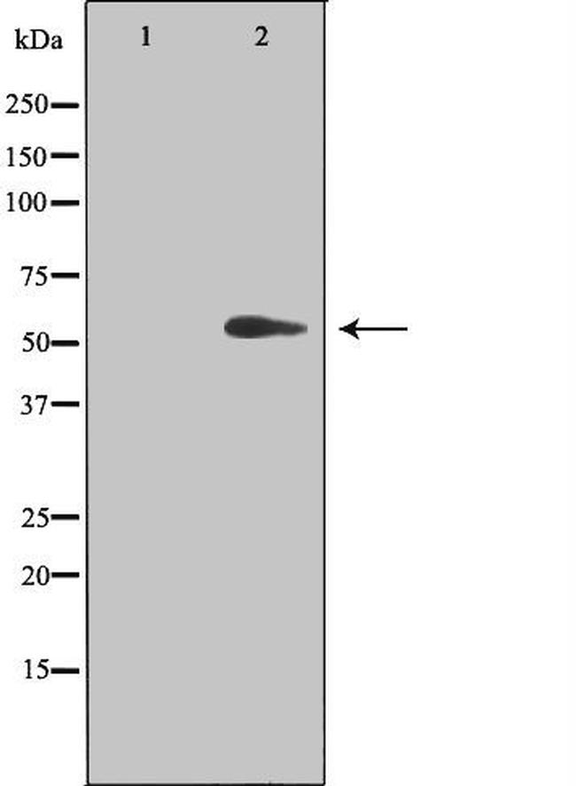 TIN2 Antibody in Western Blot (WB)
