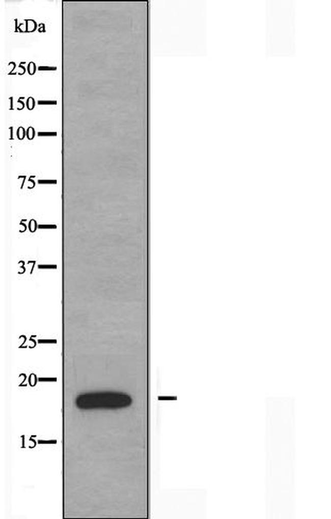 PBOV1 Antibody in Western Blot (WB)