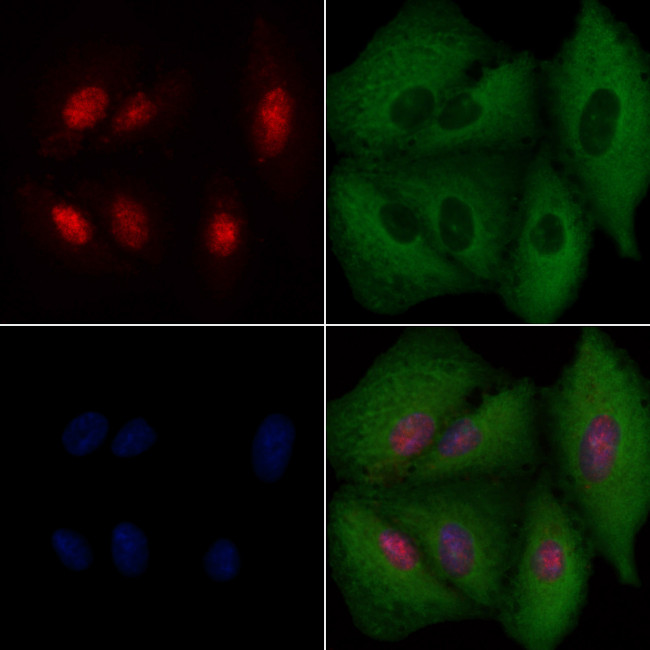 BRMS1 Antibody in Immunocytochemistry (ICC/IF)