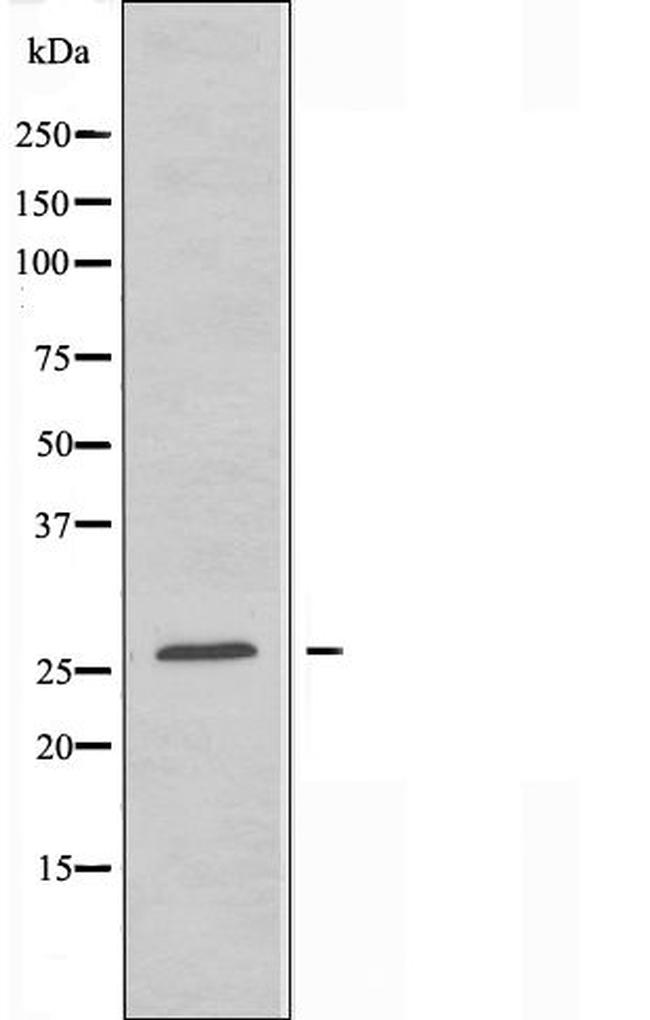 CREBZF Antibody in Western Blot (WB)