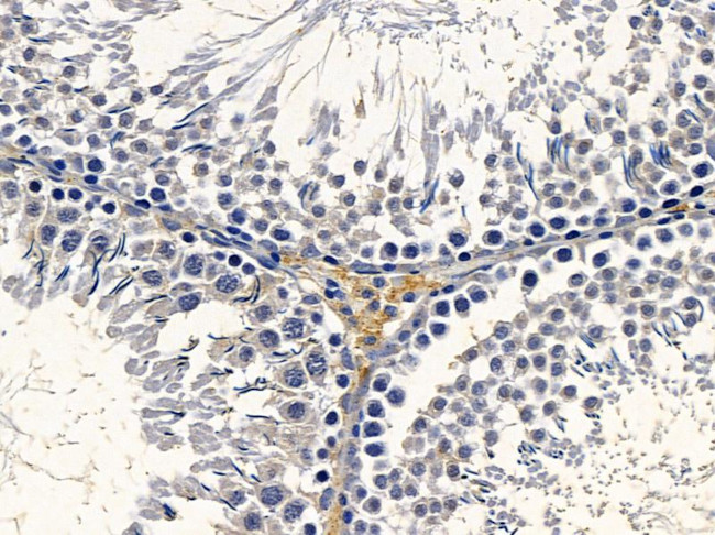 ETNK2 Antibody in Immunohistochemistry (Paraffin) (IHC (P))