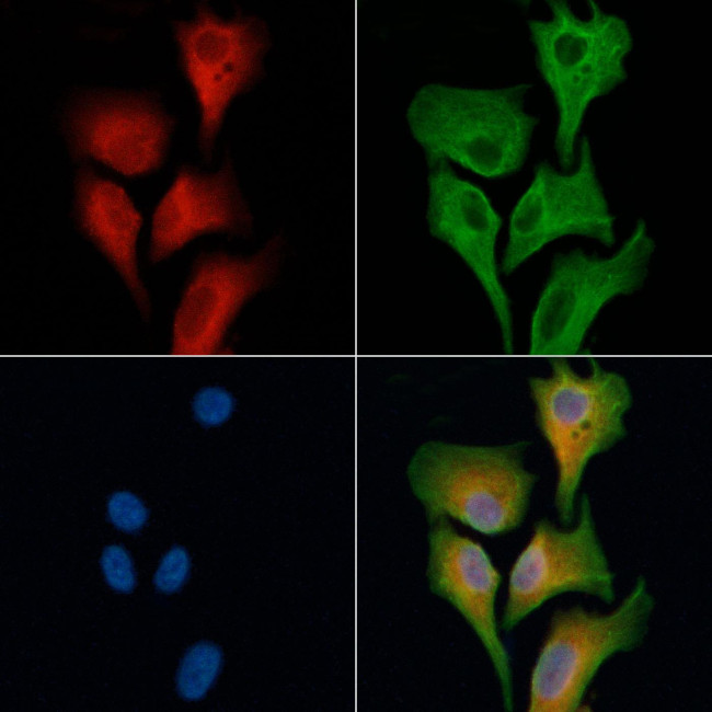 CARKL Antibody in Immunocytochemistry (ICC/IF)