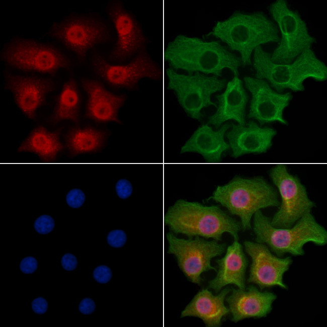 CNOT7 Antibody in Immunocytochemistry (ICC/IF)