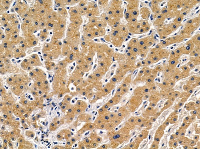 CHKB Antibody in Immunohistochemistry (Paraffin) (IHC (P))
