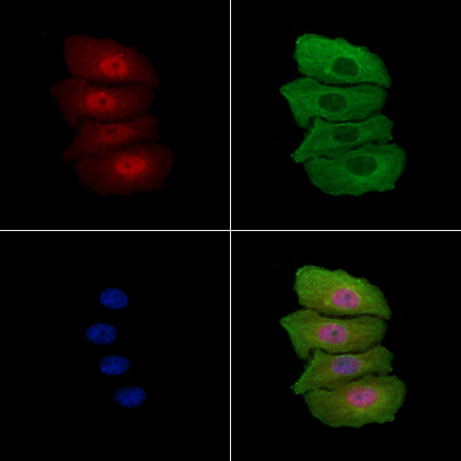 ATF5 Antibody in Immunocytochemistry (ICC/IF)