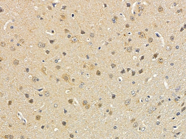 SPIN1 Antibody in Immunohistochemistry (Paraffin) (IHC (P))