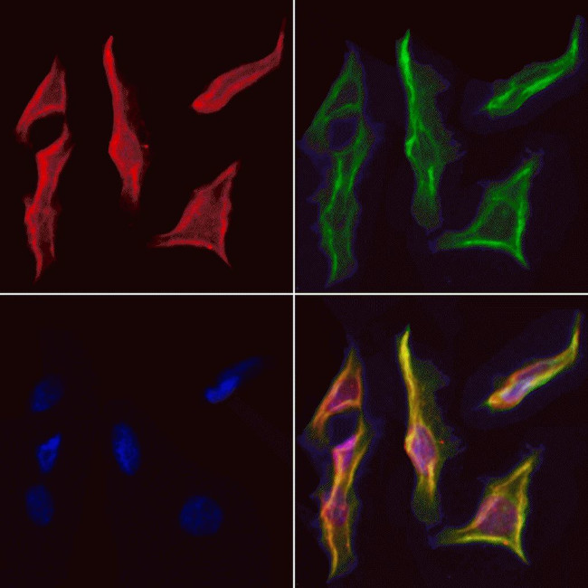 CDCA3 Antibody in Immunocytochemistry (ICC/IF)