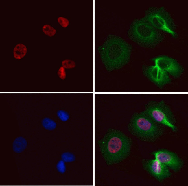 CDCA7 Antibody in Immunocytochemistry (ICC/IF)