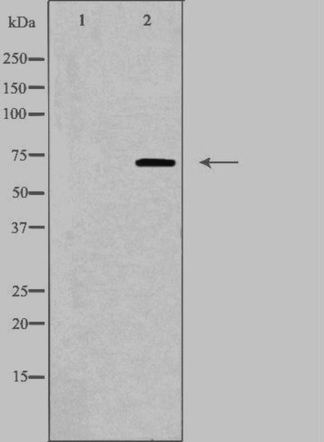 COL13A1 Antibody in Western Blot (WB)