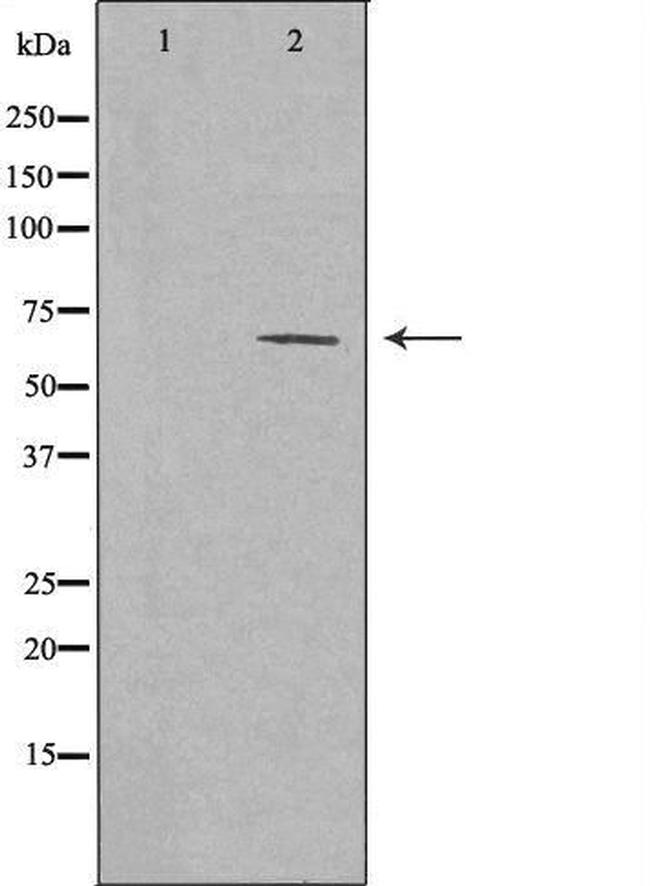 CLAC-P Antibody in Western Blot (WB)