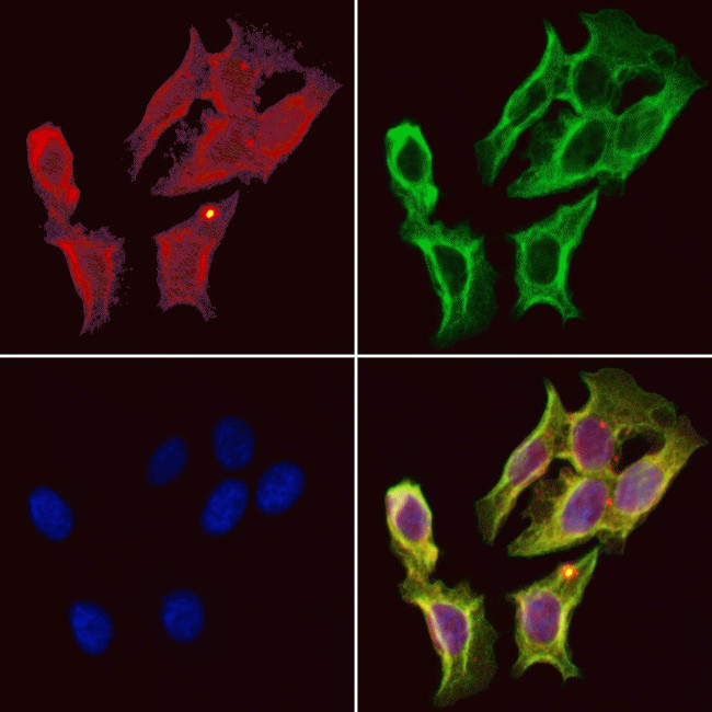 CYP21A2 Antibody in Immunocytochemistry (ICC/IF)