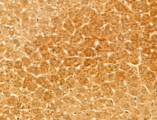CYP27A1 Antibody in Immunohistochemistry (Paraffin) (IHC (P))