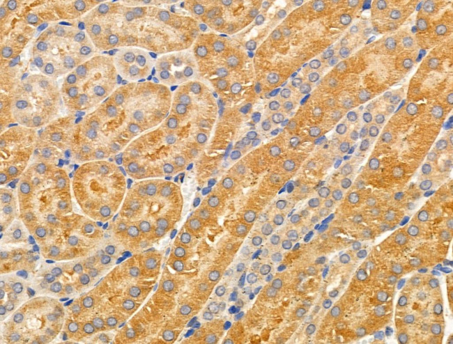 CYP4X1 Antibody in Immunohistochemistry (Paraffin) (IHC (P))