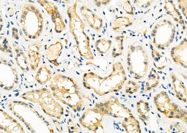 CIDEB Antibody in Immunohistochemistry (Paraffin) (IHC (P))