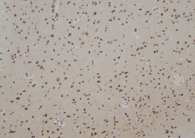 RAD51B Antibody in Immunohistochemistry (Paraffin) (IHC (P))