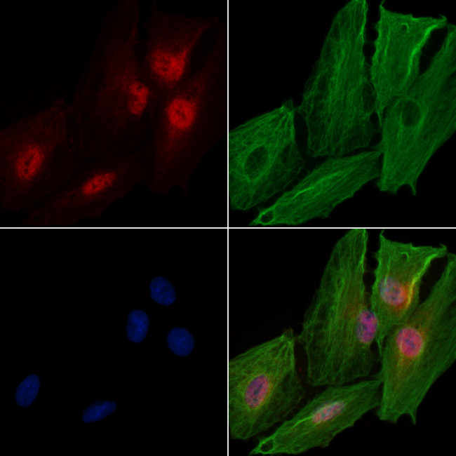 RAD54L Antibody in Immunocytochemistry (ICC/IF)