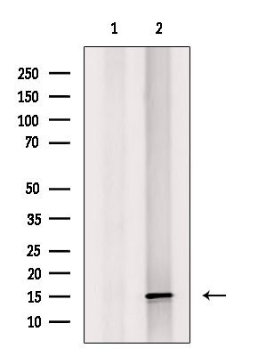 MRPS16 Antibody in Western Blot (WB)