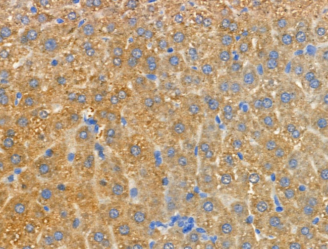 MRPL20 Antibody in Immunohistochemistry (Paraffin) (IHC (P))