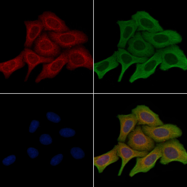 MRPL22 Antibody in Immunocytochemistry (ICC/IF)