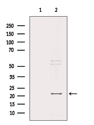MRPL32 Antibody in Western Blot (WB)