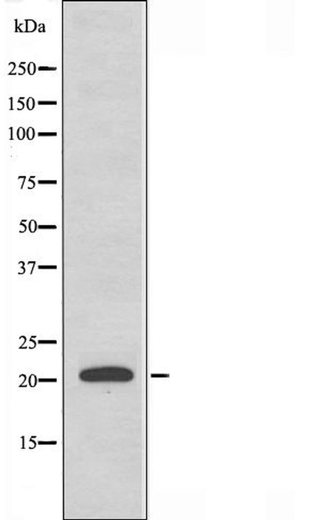 MRPL41 Antibody in Western Blot (WB)