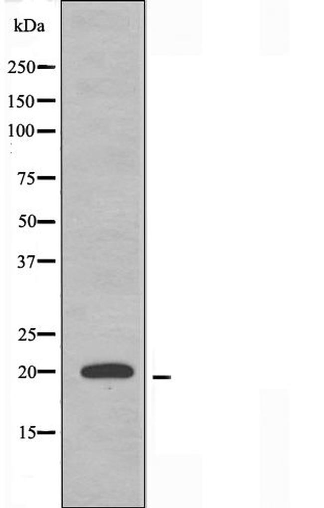 MRPL51 Antibody in Western Blot (WB)