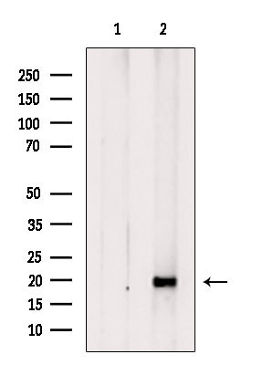 RPS11 Antibody in Western Blot (WB)