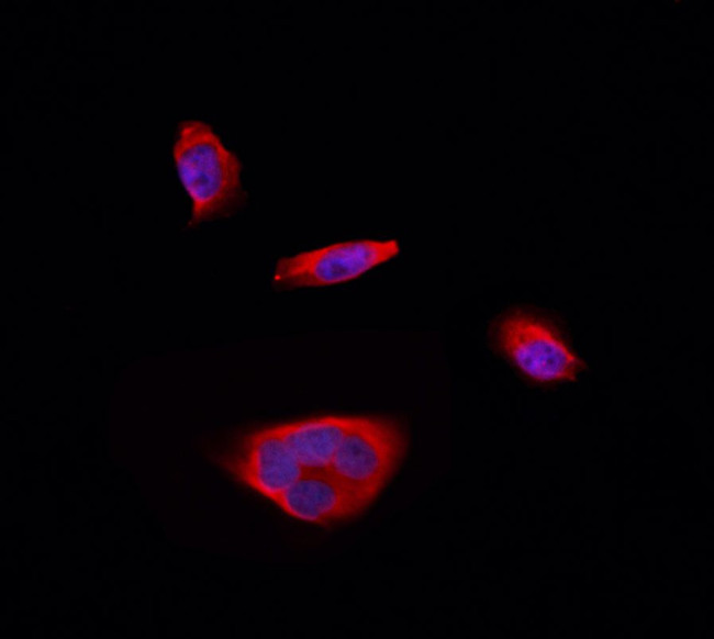 RPS12 Antibody in Immunocytochemistry (ICC/IF)
