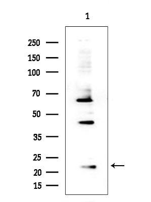 RPS15 Antibody in Western Blot (WB)