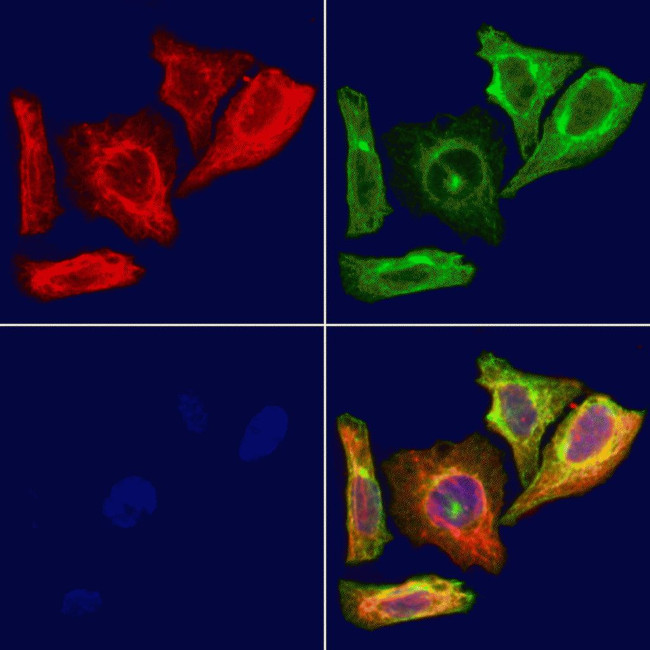 RPS20 Antibody in Immunocytochemistry (ICC/IF)