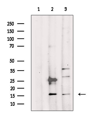 RPS23 Antibody in Western Blot (WB)