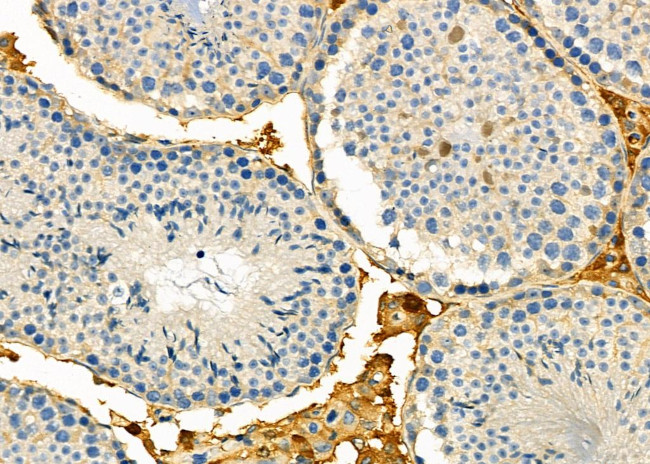 RPS5 Antibody in Immunohistochemistry (Paraffin) (IHC (P))