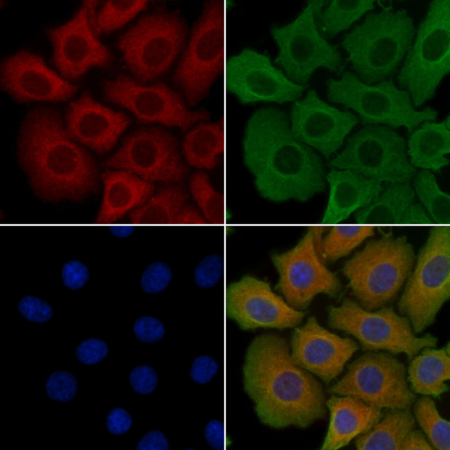 RPS7 Antibody in Immunocytochemistry (ICC/IF)