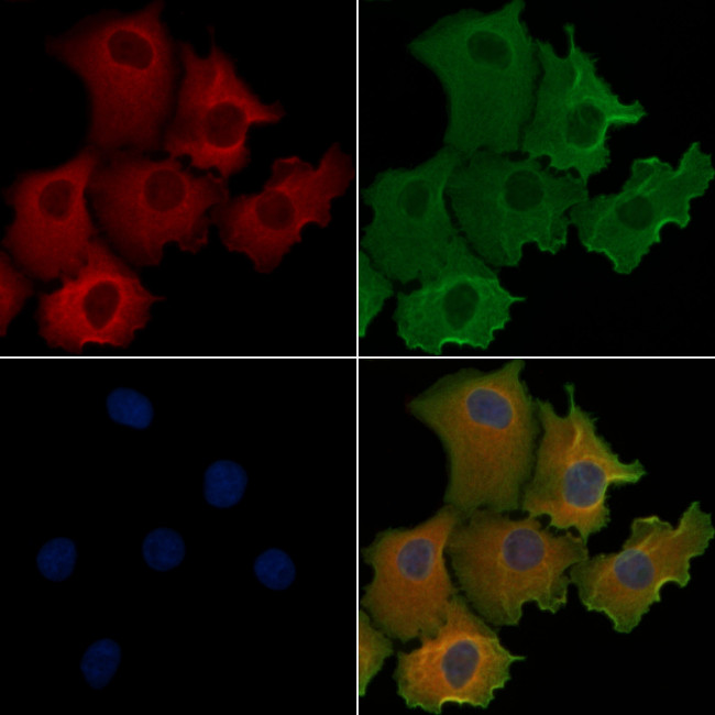 AZI1 Antibody in Immunocytochemistry (ICC/IF)